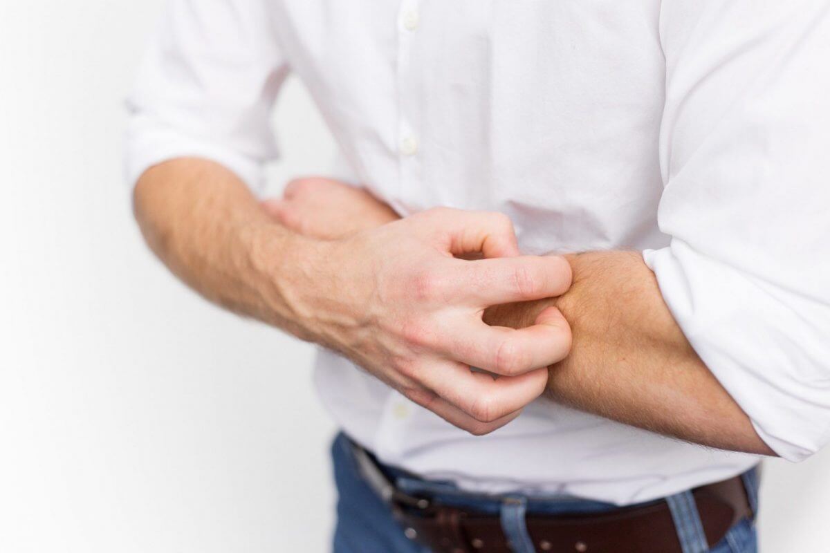 Homem coçando os braços devido à dermatite de contato