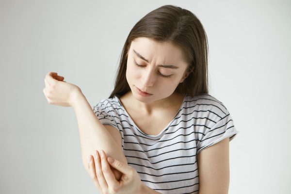 Adolescente coçando o braço com dermatite