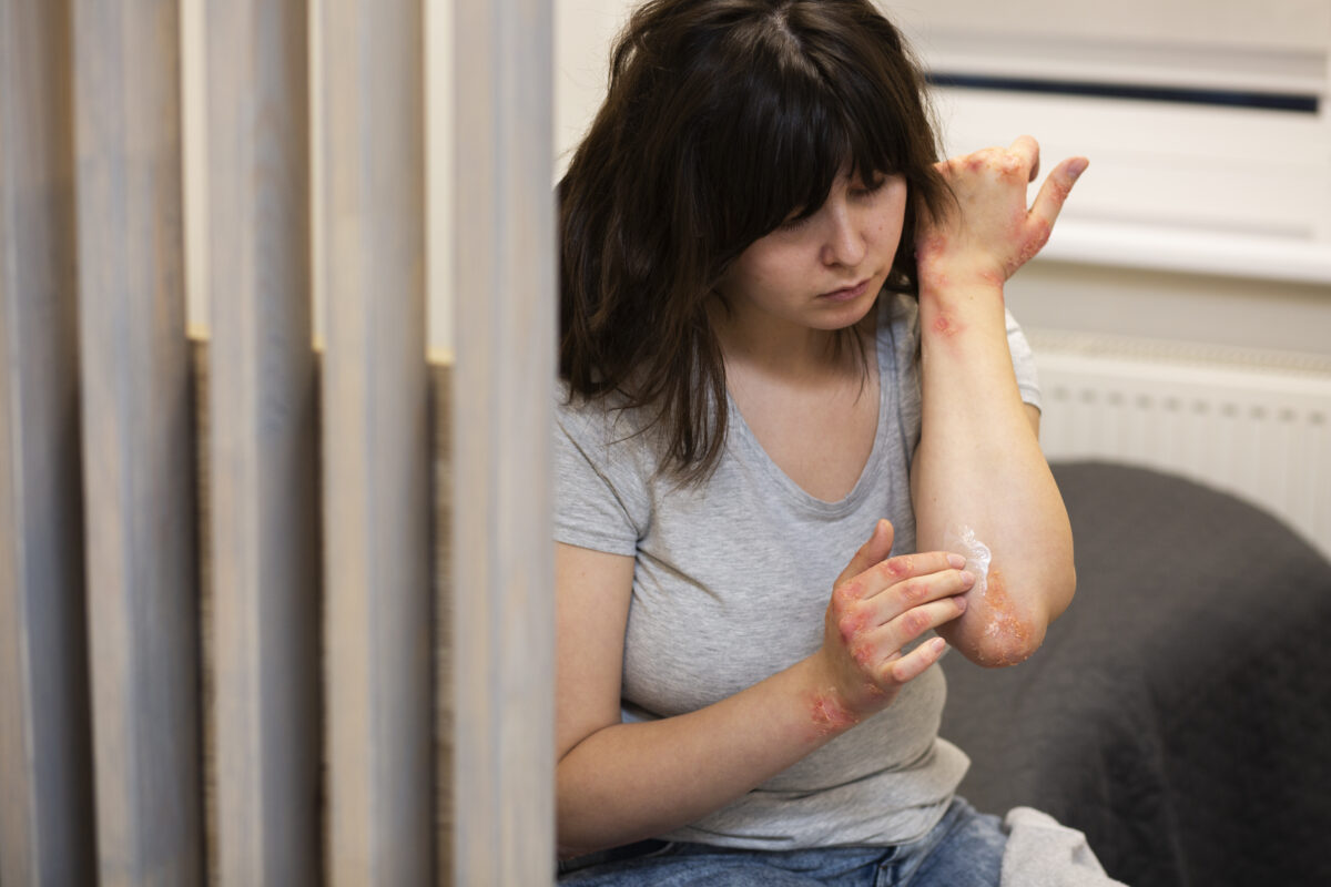 alergia de pele