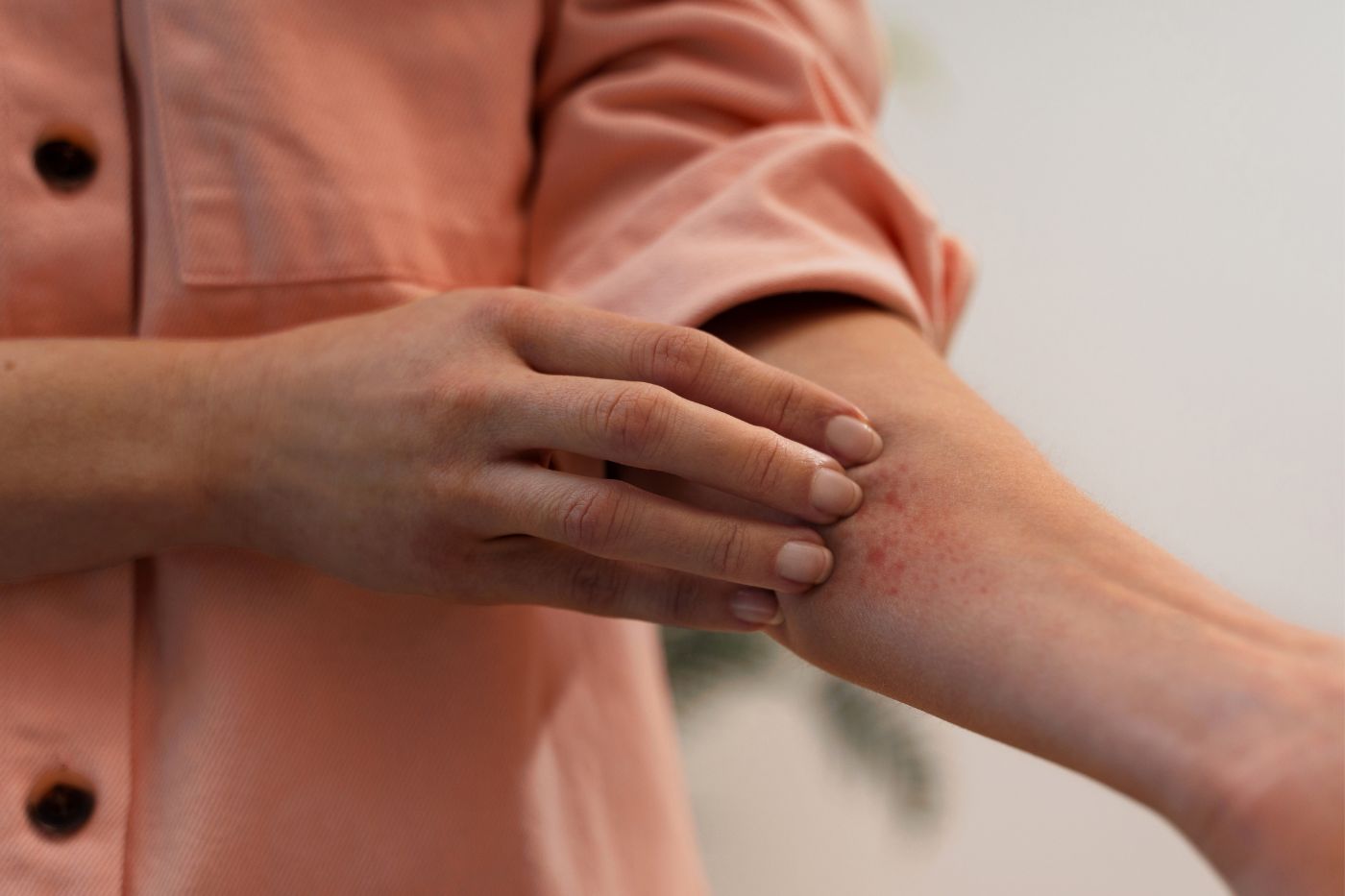 Kathon CG: o que é e por que pode causar alergia na pele