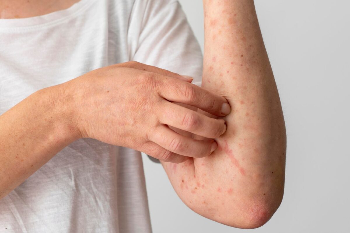 Alergia a produto de limpeza: como evitar e proteger sua pele
